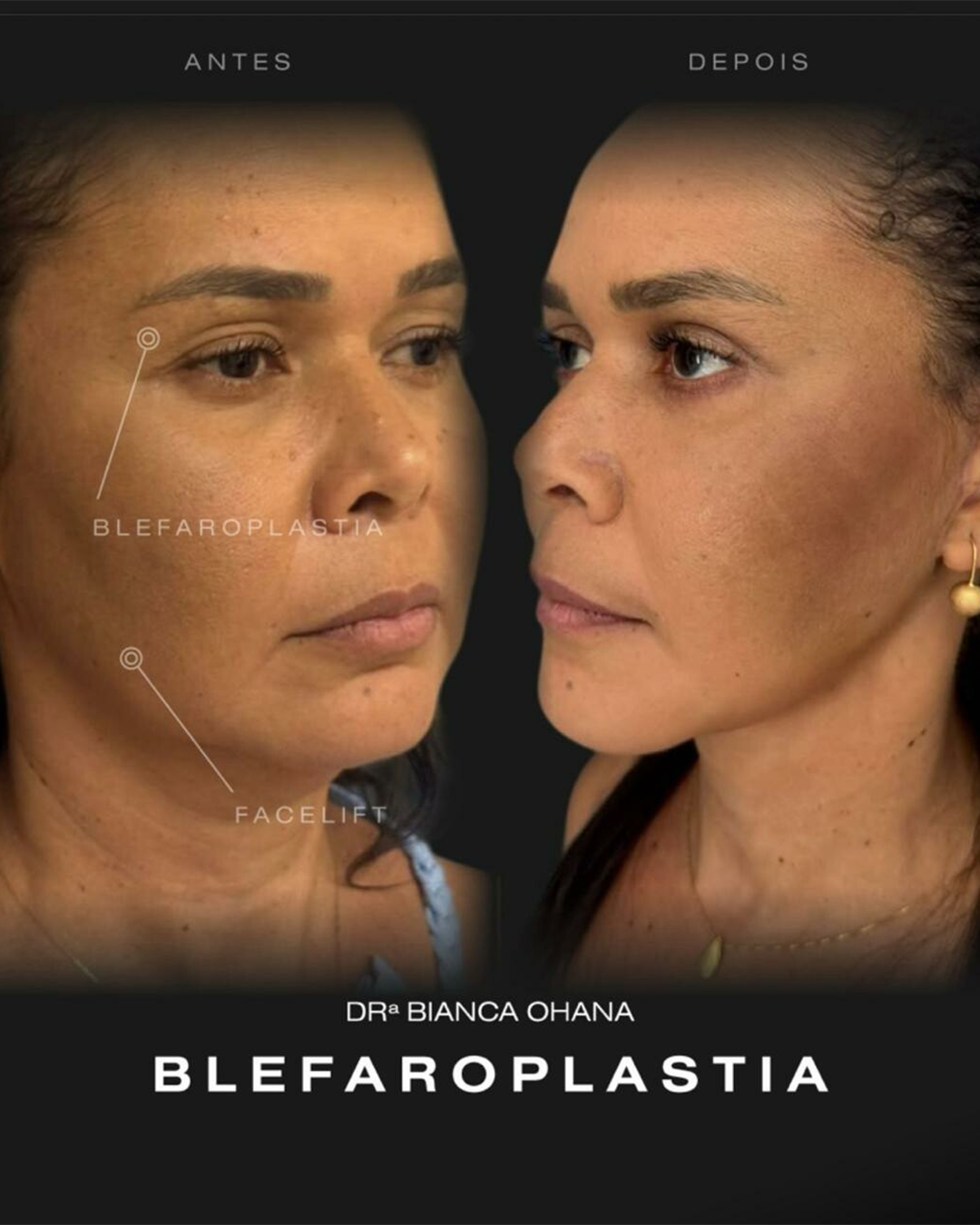 Prancheta 1 copiar 2