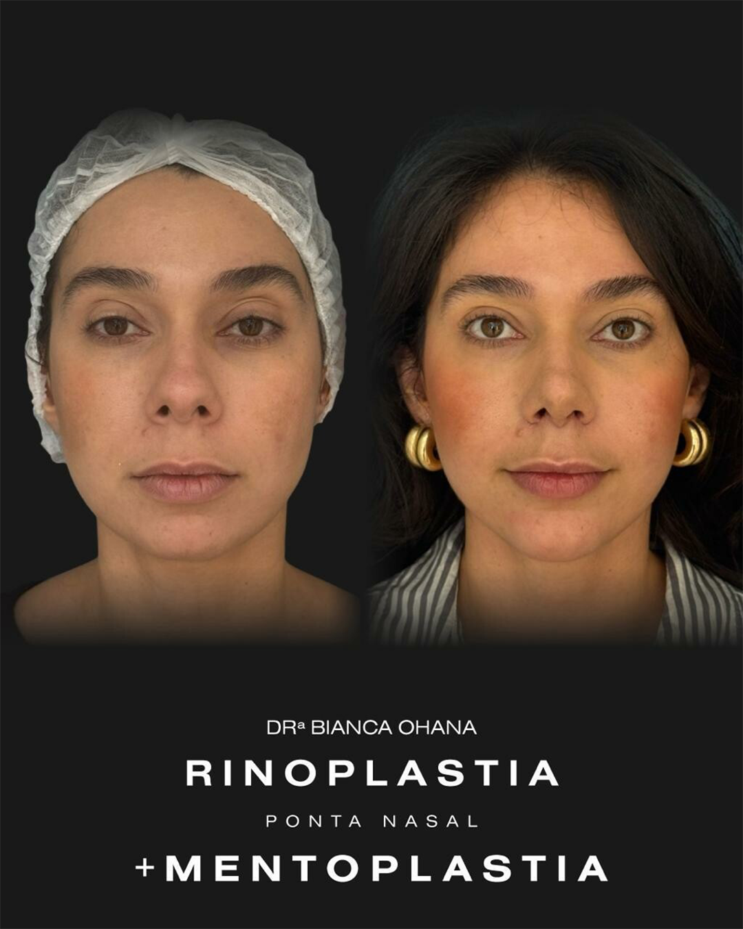 Prancheta 2 copiar 2