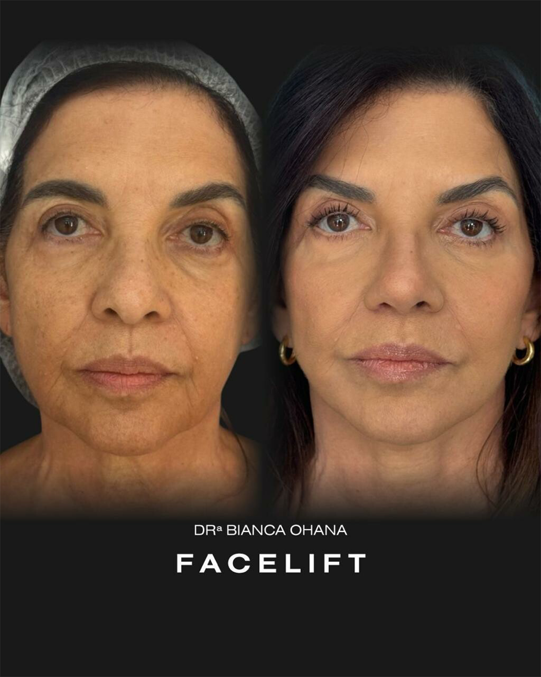 Prancheta 3 copiar 2