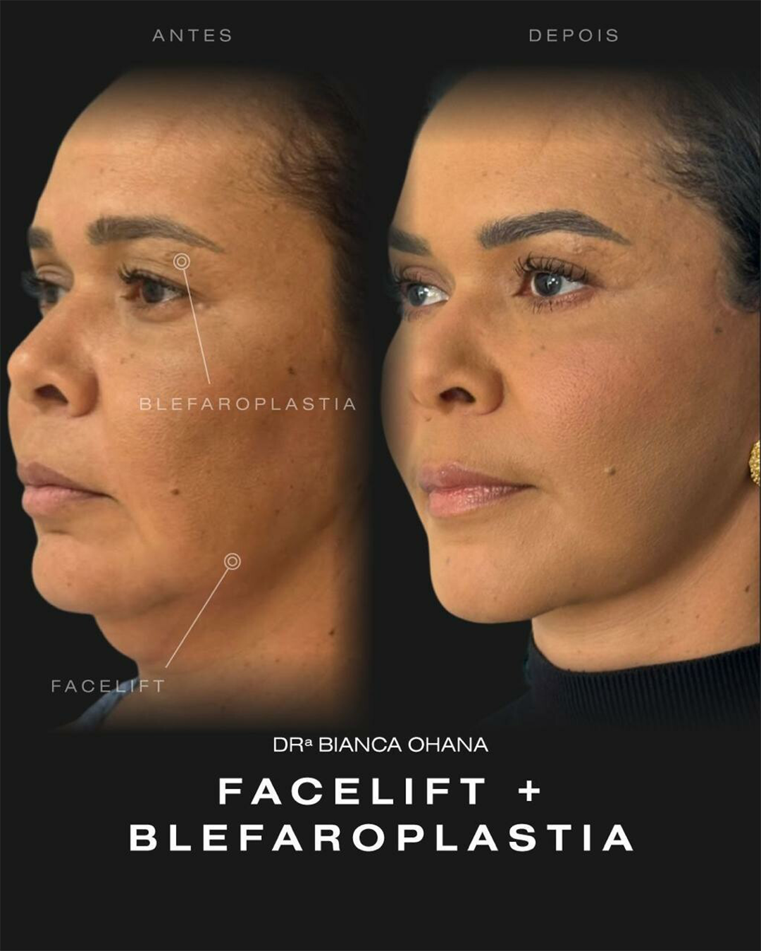 Prancheta 4 copiar 2